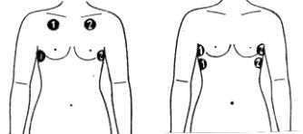 Миостимуляция плеча